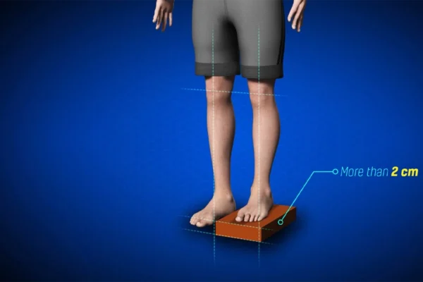 leg lenght discrepency
